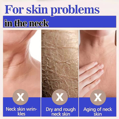 Collagen Neck Cream Eliminate Neck Wrinkle Lines Lifting Whitening Tighten Double Chin Anti-age Rejuvenation Skin Care Cream (Available)